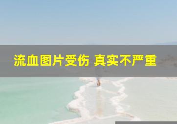 流血图片受伤 真实不严重